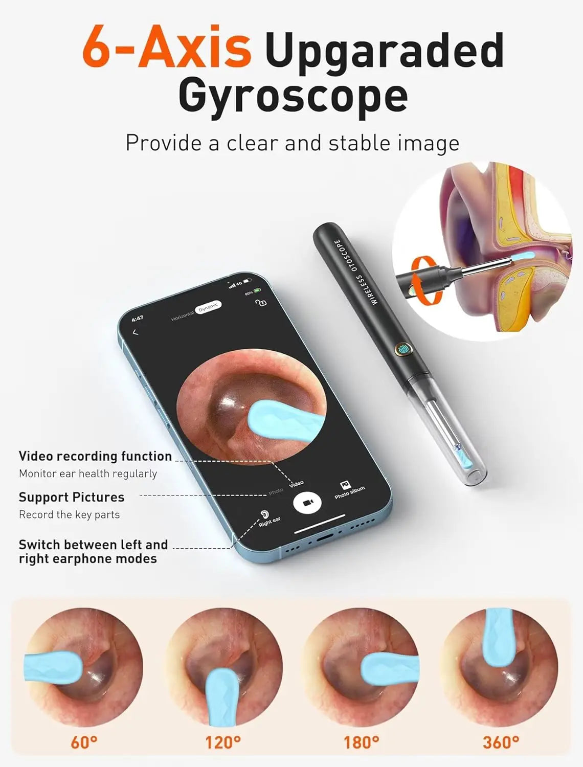 1080P HD Ear Wax Removal Tool Camera with 50 Tips, Otoscope for iPhone Android